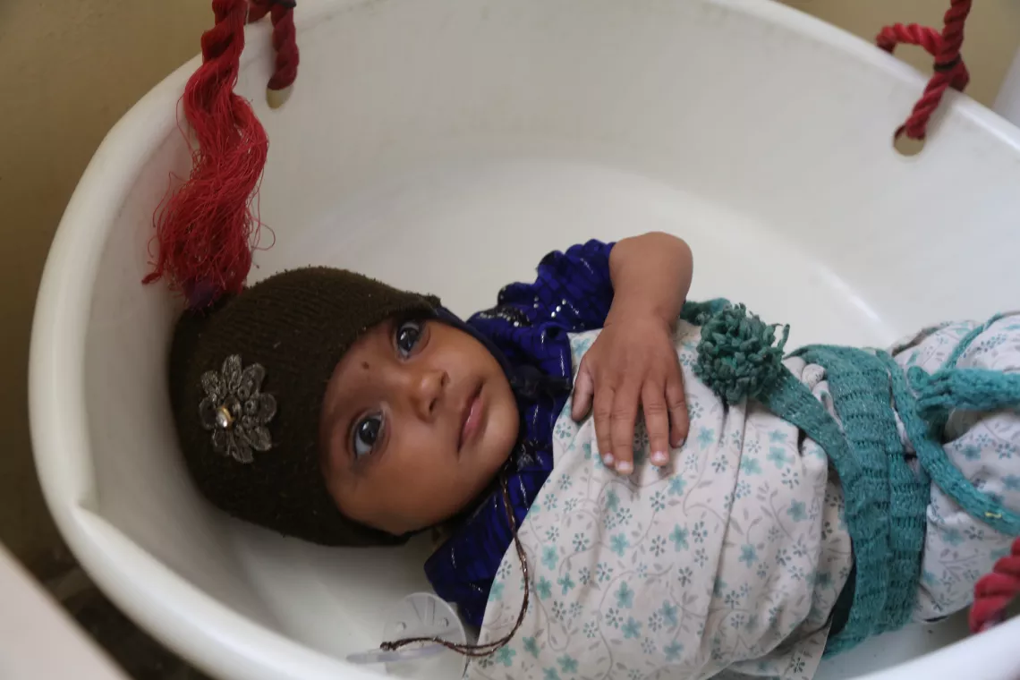 Safa, 7 months old, is suffering from severe acute malnutrition (SAM). Her parents have brought her for treatment at the nutrition department in Mirza Mohammad Khan Comprehensive Health Center (CHC), Kandahar City. Safa is now in her third visit to the CHC, with her mid-upper arm circumference (MUAC) measuring 10 cm, an improvement from 9 cm during her last visit. 
