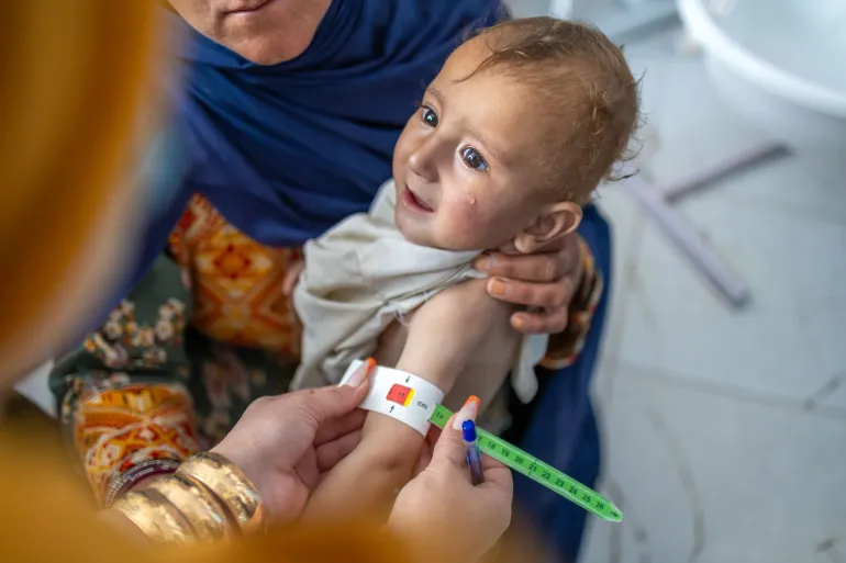 Susan Noorzai conducts a Mid-Upper Arm Circumference (MUAC) screening for Omid, a 10-month-old boy, to assess his nutritional status and monitor his growth.