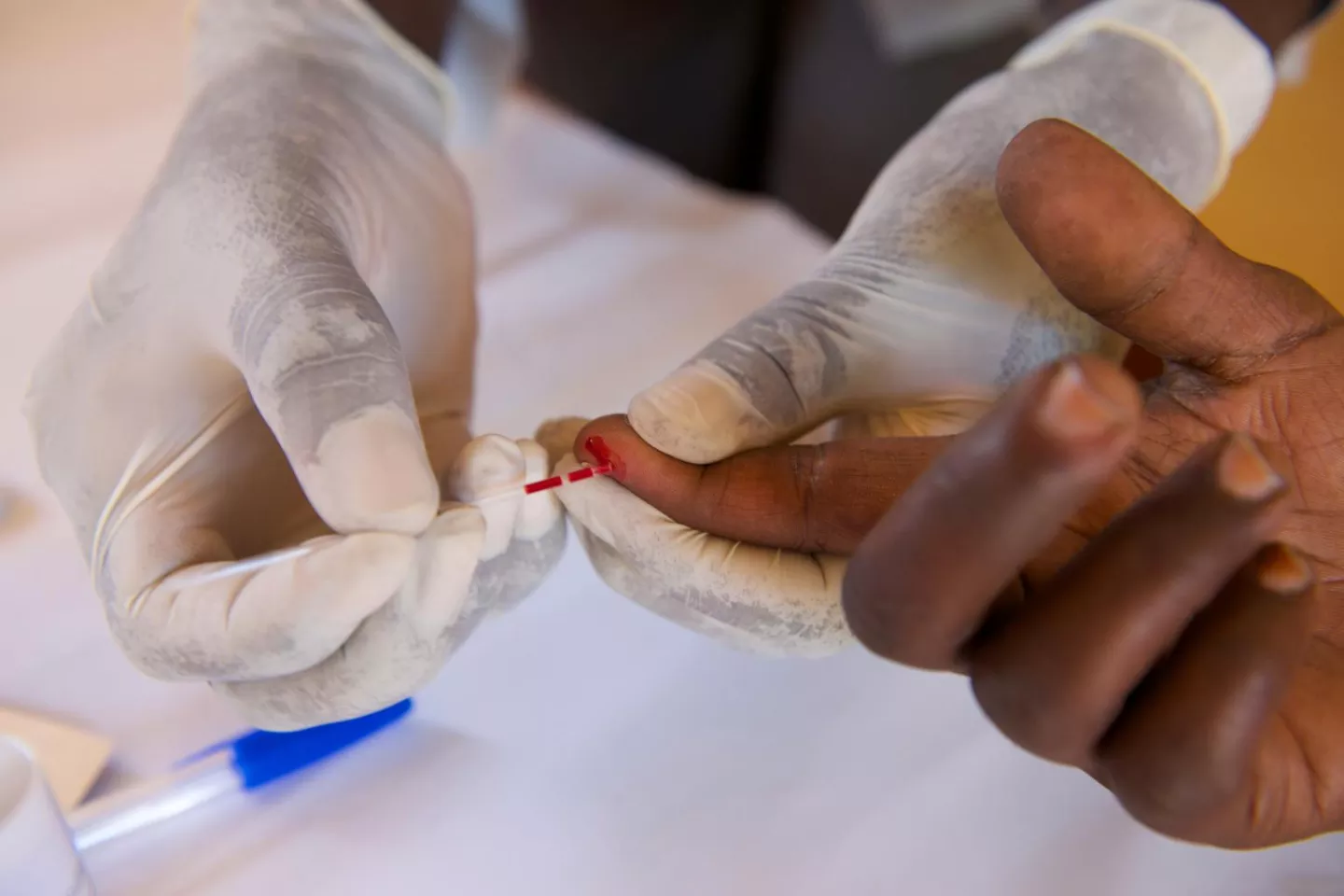 Midwife collects a blood sample from the finger of a pregnant woman for HIV screening during a consultation at a hospital