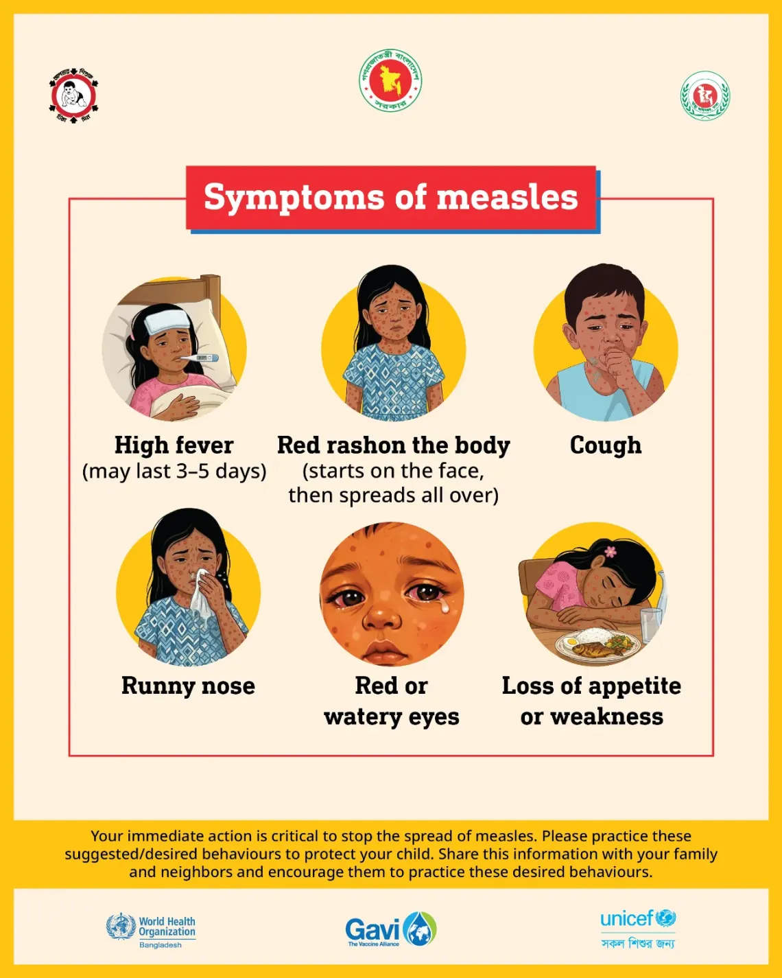 Symptoms of measles