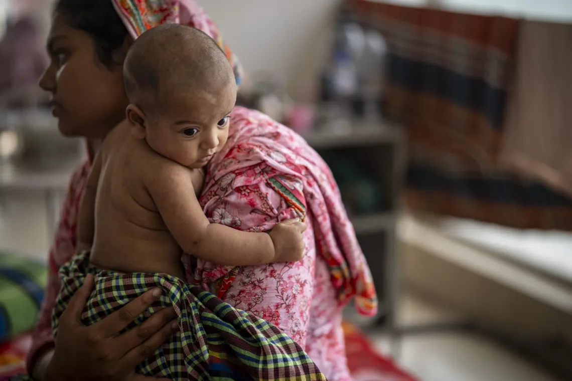 Safwan, 5 months, with visible measles rash, is cared for by his mother at Mohakhali DNCC Hospital 