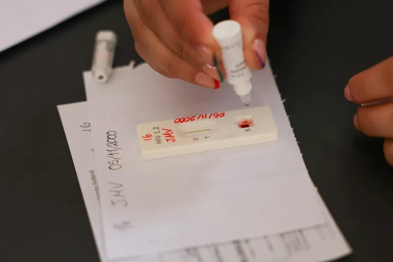 Exame de HIV