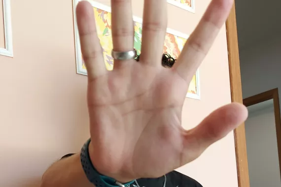 Foto mostra uma m&atilde;o