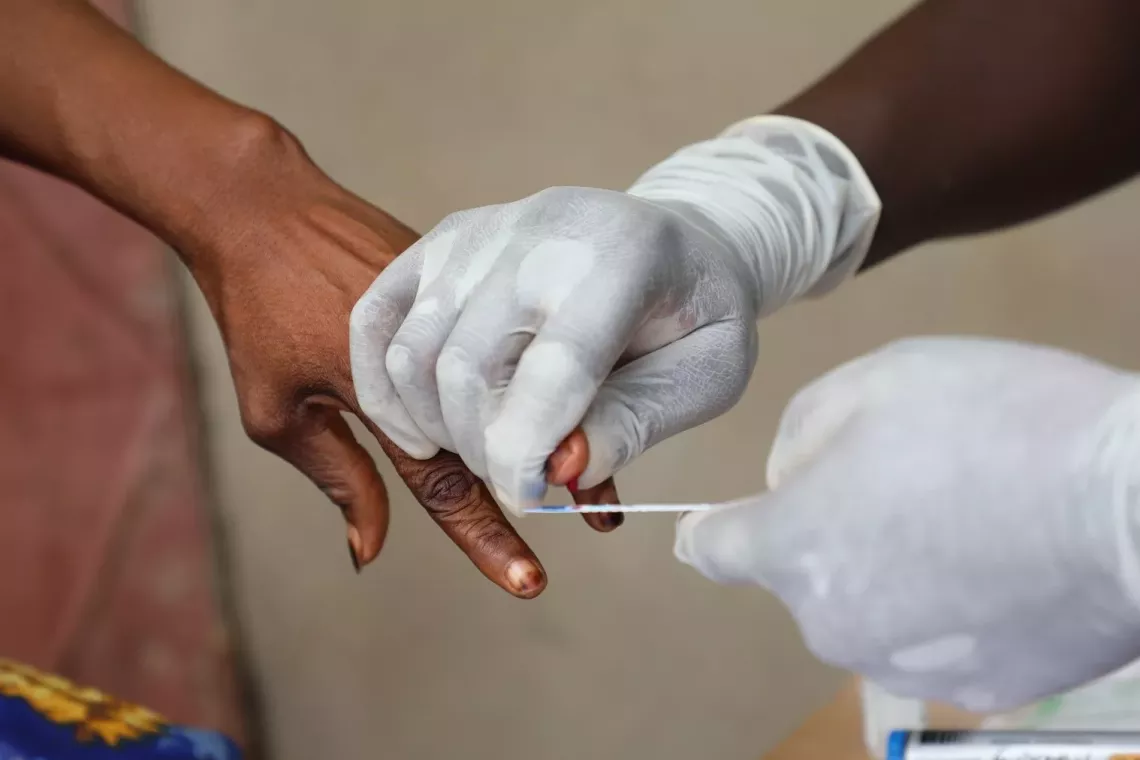 HIV test