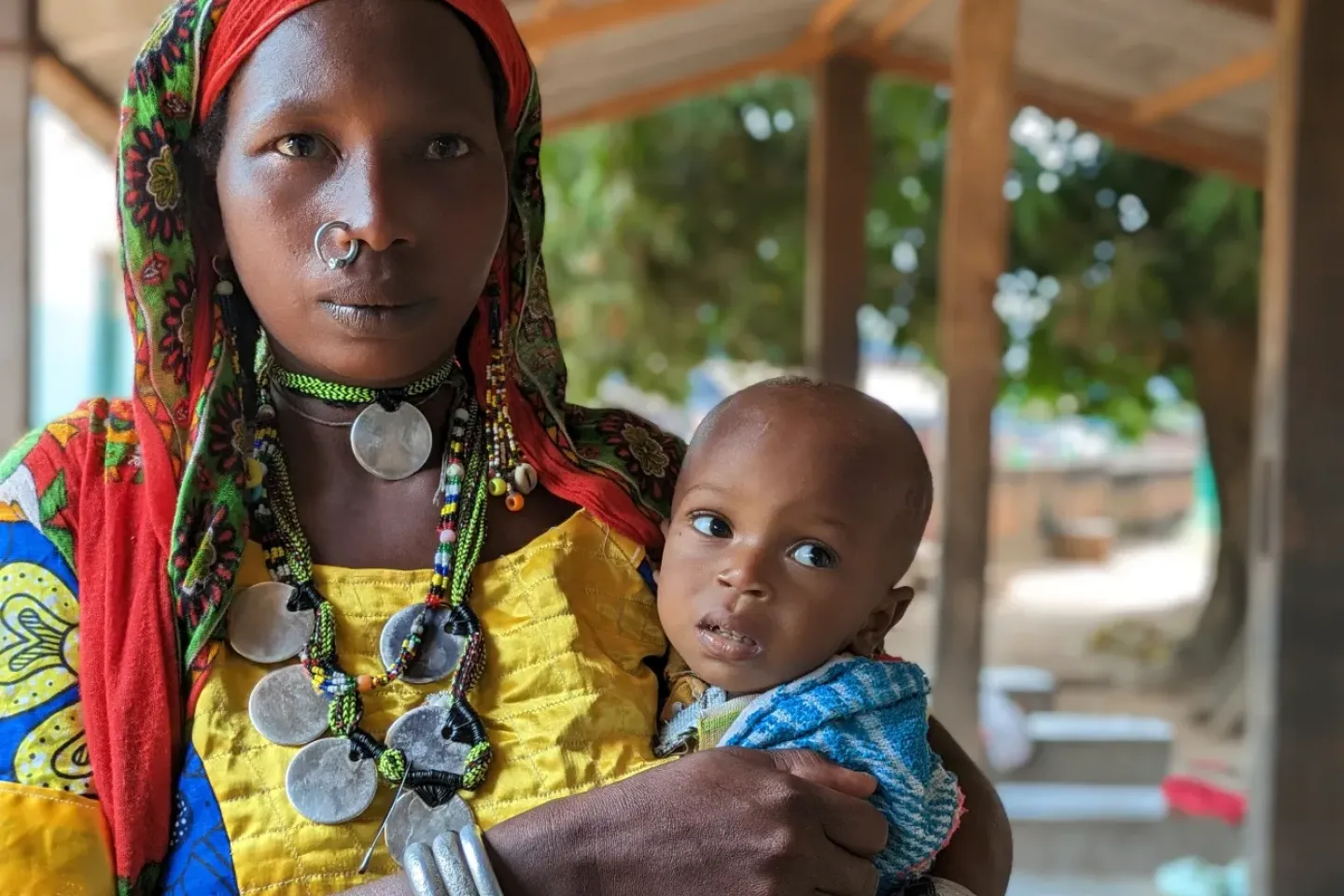 Amina Ibrahim tient son fils Musa dans ses bras, &agrave; la clinique pour enfants souffrant de malnutrition de l'h&ocirc;pital de Batangafo.