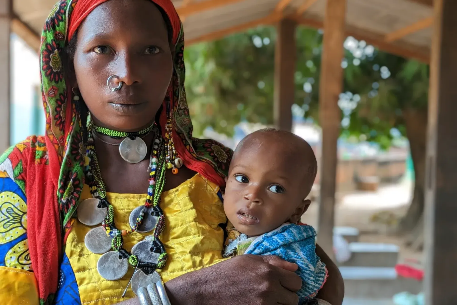Amina Ibrahim holds her son Musa, at the clinic for malnourished children in Batangafo hospital.  
