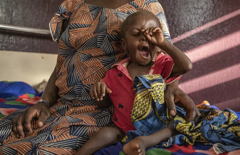 Un enfant souffrant de malnutrition recevant un traitement &agrave; l'h&ocirc;pital de malnutrition de Bossangoa.