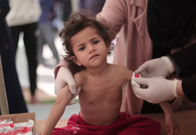 ni&ntilde;o est&aacute; recibiendo medici&oacute;n de circunferencia de brazo