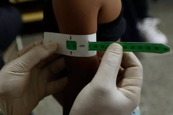 Un trabajador de la salud le mide la circumferencia del brazo a una ni&ntilde;a