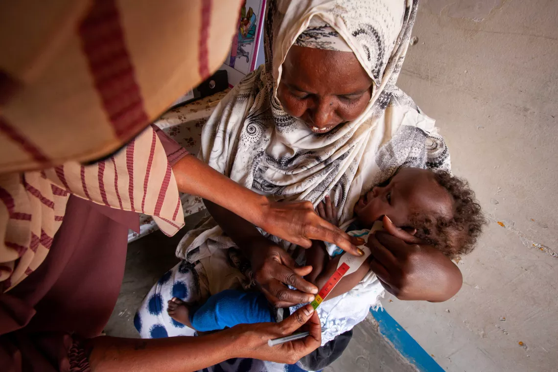   Consultation d'un jeune enfant souffrant de malnutrition