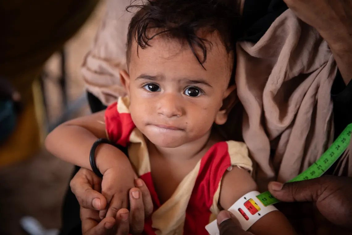 Aziz, &acirc;g&eacute; de 14 mois et souffrant de malnutrition aigu&euml; s&eacute;v&egrave;re