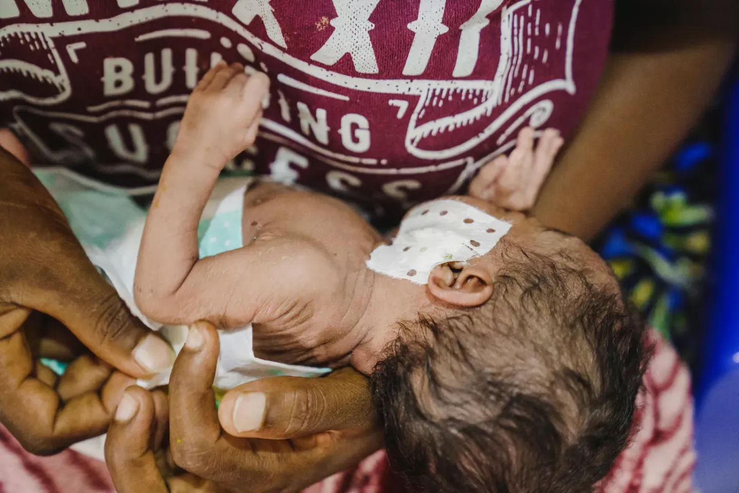 Un enfant avec une oreille band&eacute;e dans les bras d'une femme