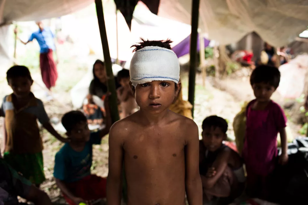 Rohingya children, attacked in and driven from their homes, fled Myanmar to seek refuge in in neighbouring Bangladesh. Mohammed Yasin, 8, is among newly arrived Rohingya sheltering in the Kutupalong makeshift refugee camp in Bangladesh’s Cox’s Bazar district