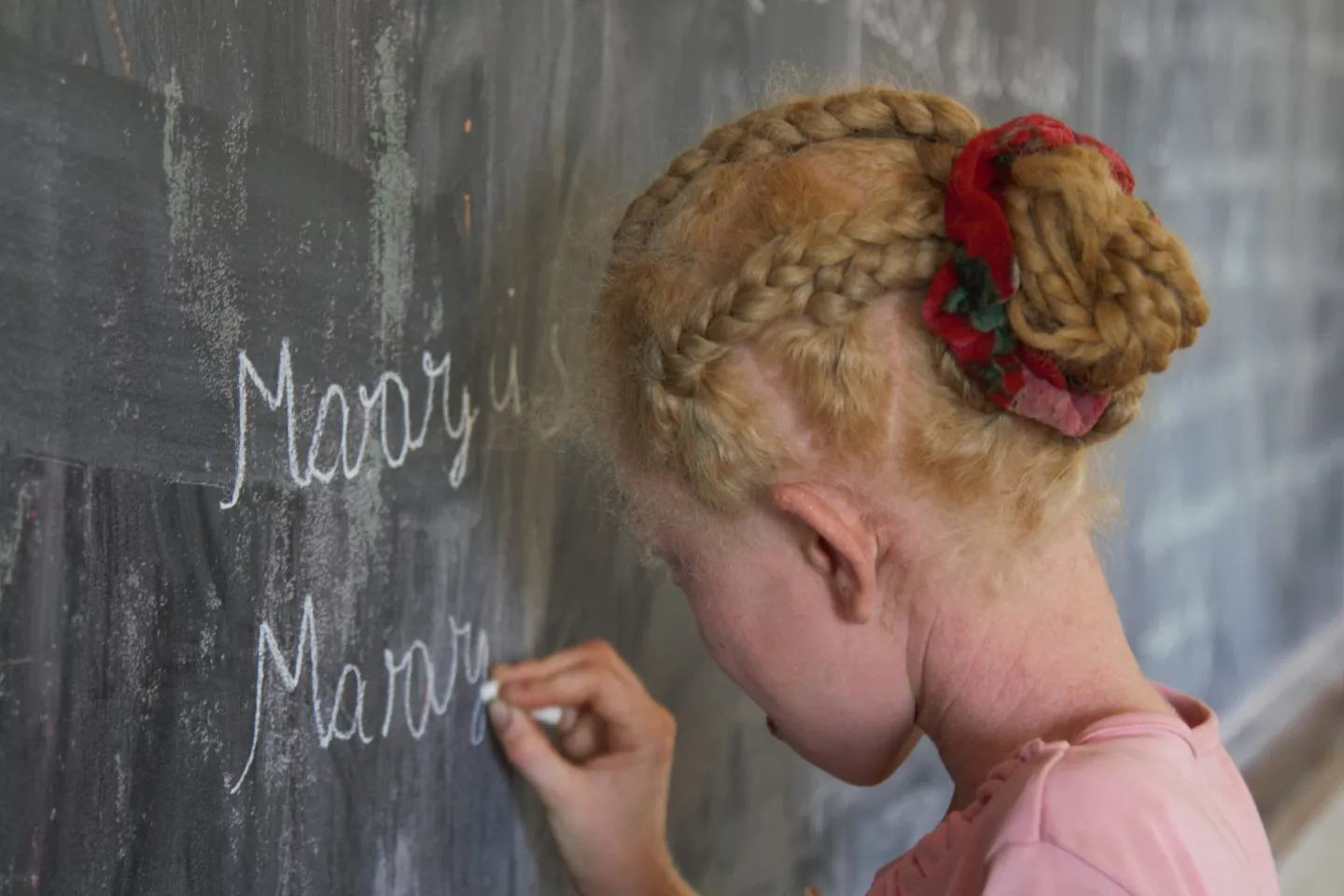 An adolescent girl with albinism writes her dream on the board in her classroom in Madagascar