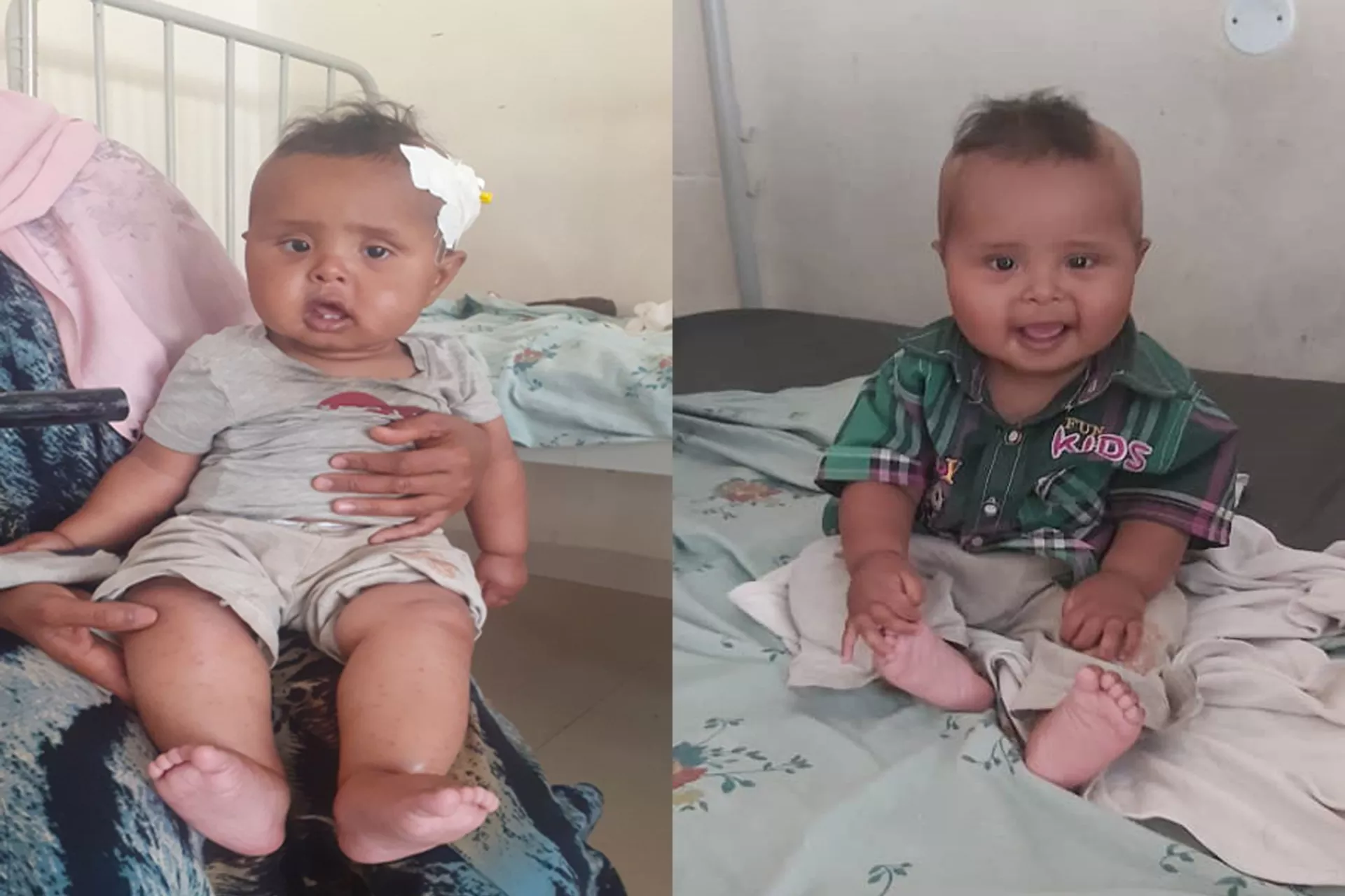Hayatu is a nine-month-old baby from Waytelo 19 Kebele (sub district), Habru Woreda (district) of North Wollo zone in Amhara Region