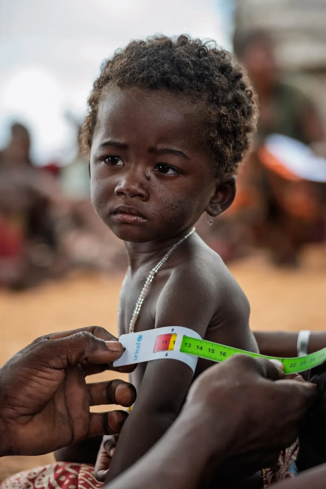 Madagascar: Antavy Nord, Tsihombe District, Androy Region, Madagascar. 22-month-old Angela is being assessed with a MUAC tape, a quick way to check malnutrition. The color zones show severity: red for severe, yellow for moderate, and green for healthy. Angela&rsquo;s measurement is at the red-yellow threshold, signaling the need for close monitoring.