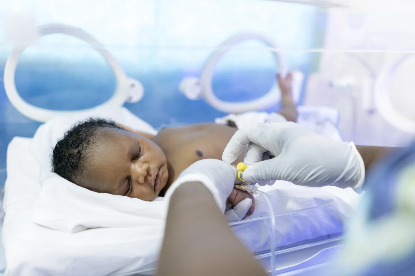 A new born at the Intensive Care Unit of Bolgatanga Regional Hospital on 20 April 2018.