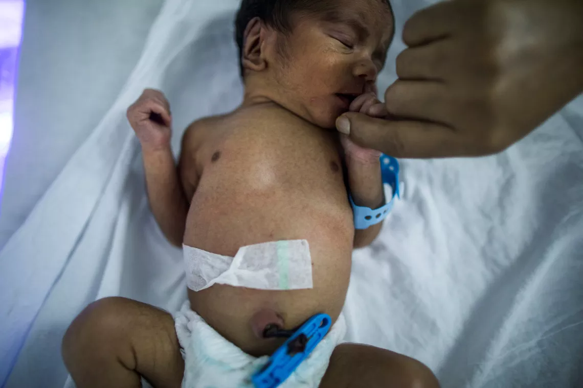 A newborn baby sleeping in SNCU facility.