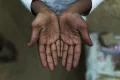13-year-old Dharmendar (Name Changed), was one of the survivors who were rescued from bangle making factory in Hyderabad in 2015. 