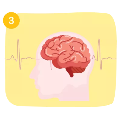 Stroke