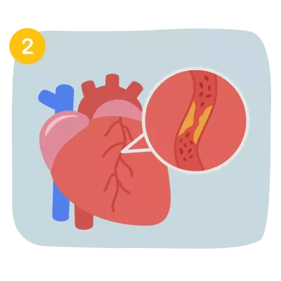 Heart disease