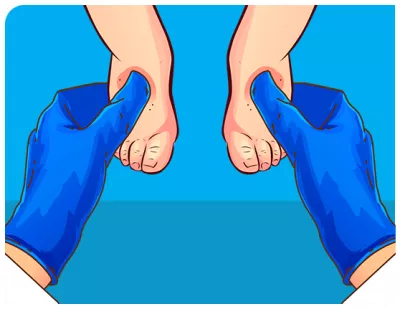 Bengkak di kedua punggung kaki