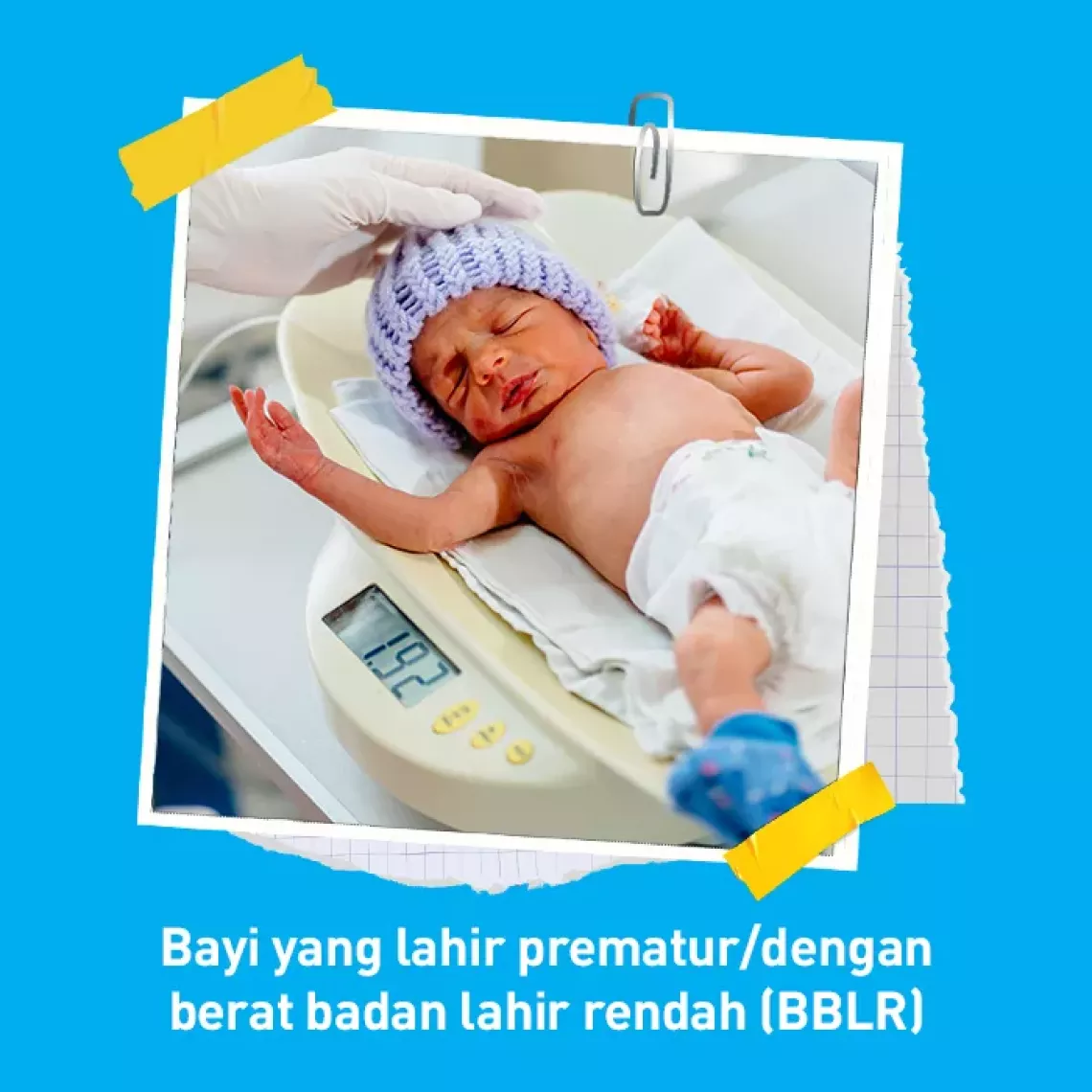 Bayi yang lahir prematur