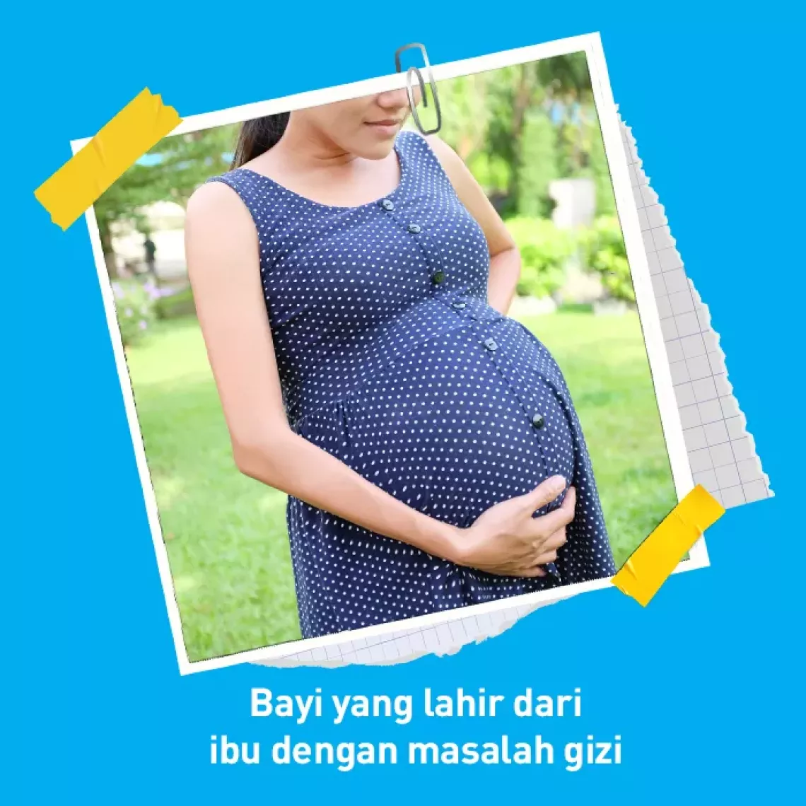 Bayi yang lahir dari ibu dengan masalah gizi