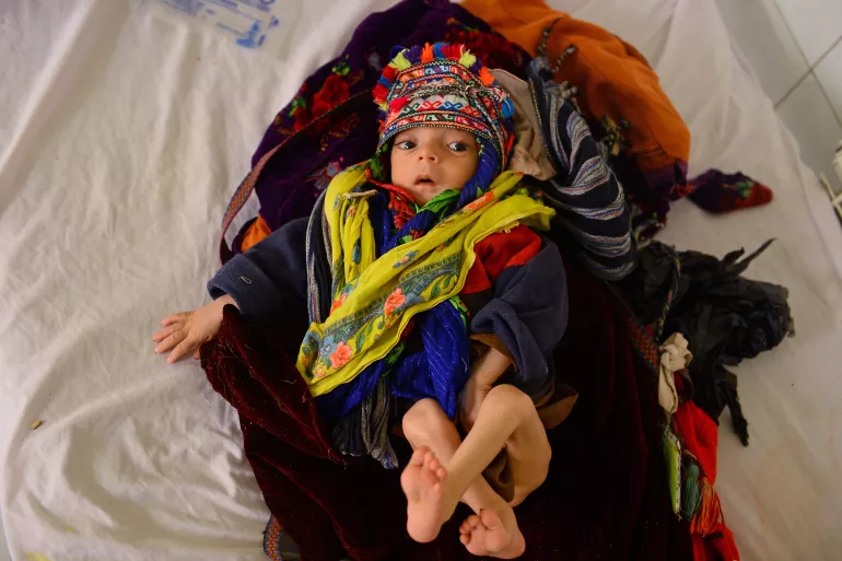 Children suffering from pneumonia