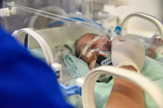 A baby in NICU