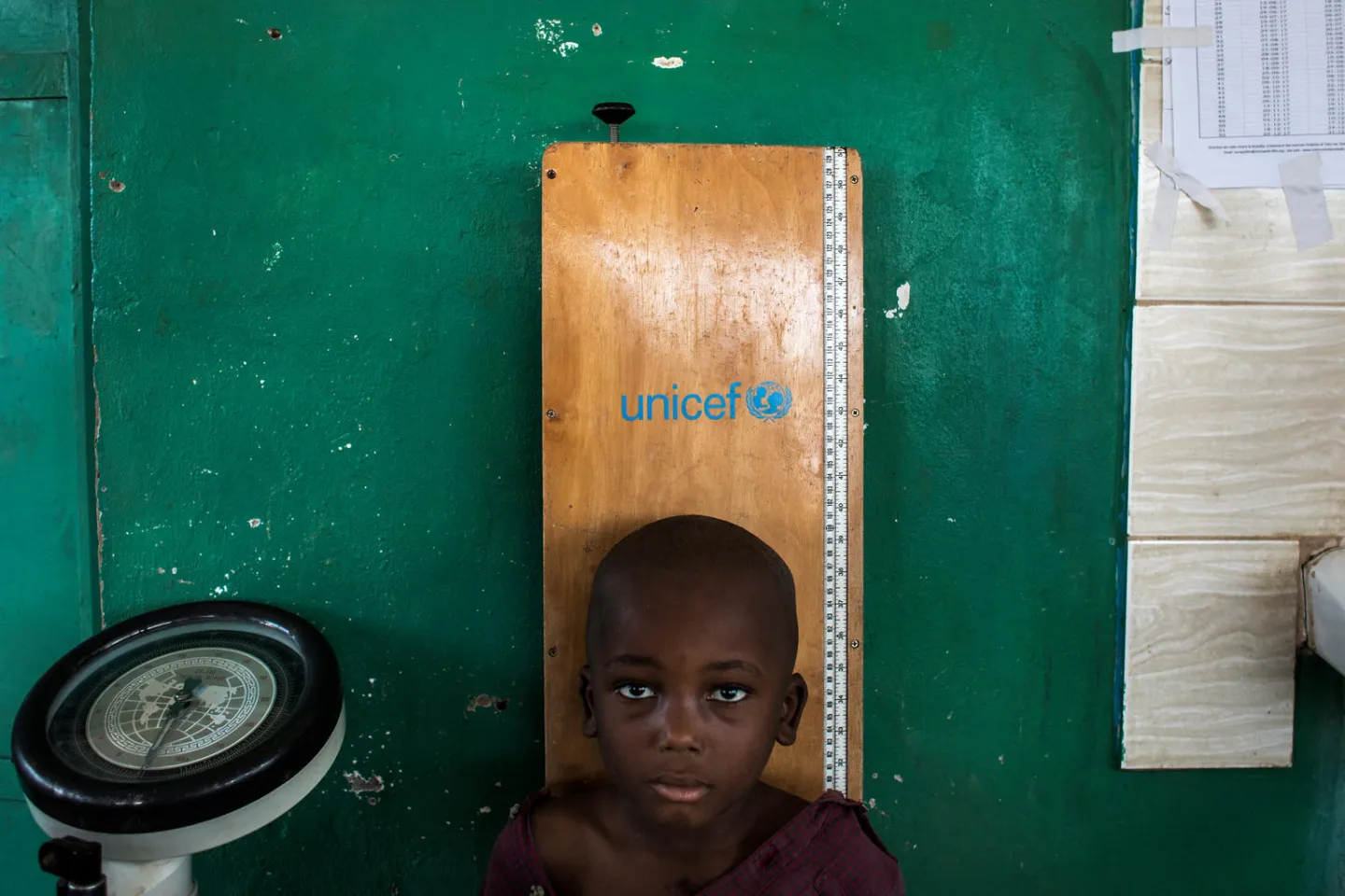 A young boy get his height measured in a UNICEF supported child clinic in Nganza, Kananga.