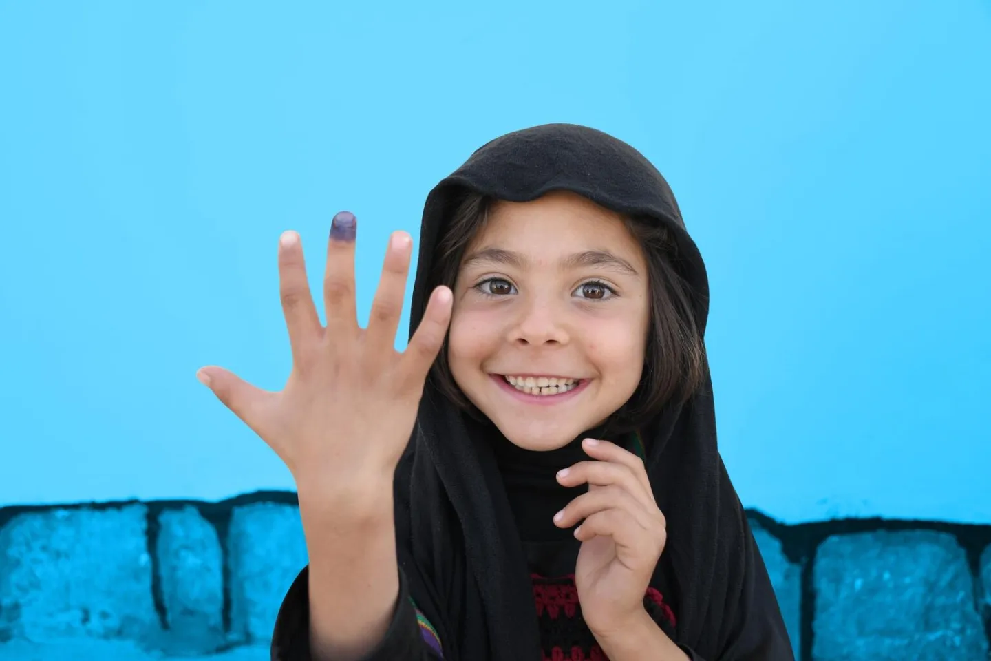 in southern Afghanistan, a girl shows her vaccination mark at the Mir Bazar Clinic.