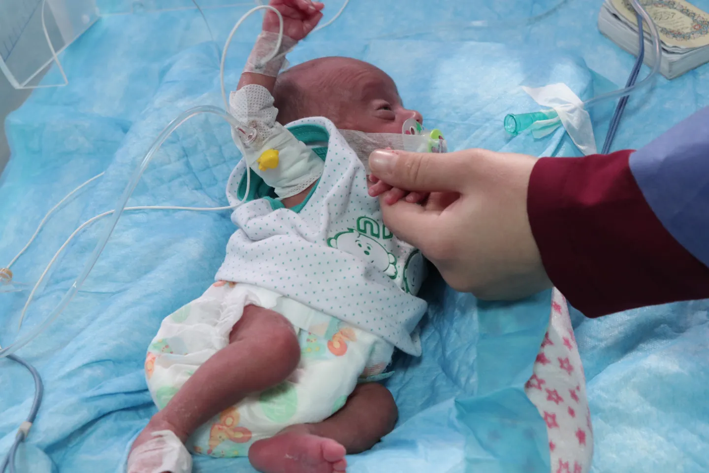 A newborn in the incubator