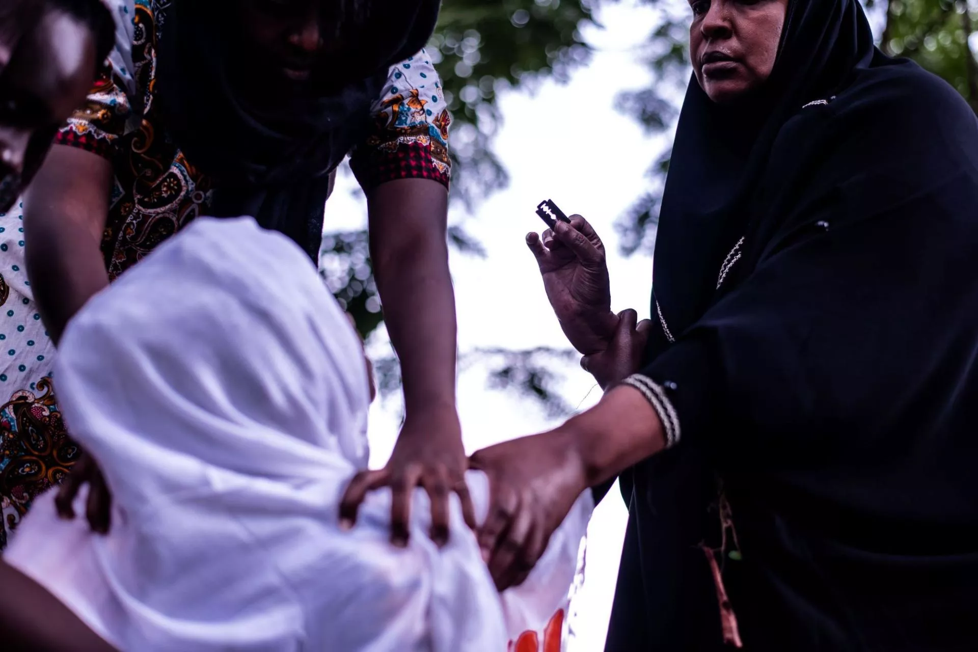 FGM