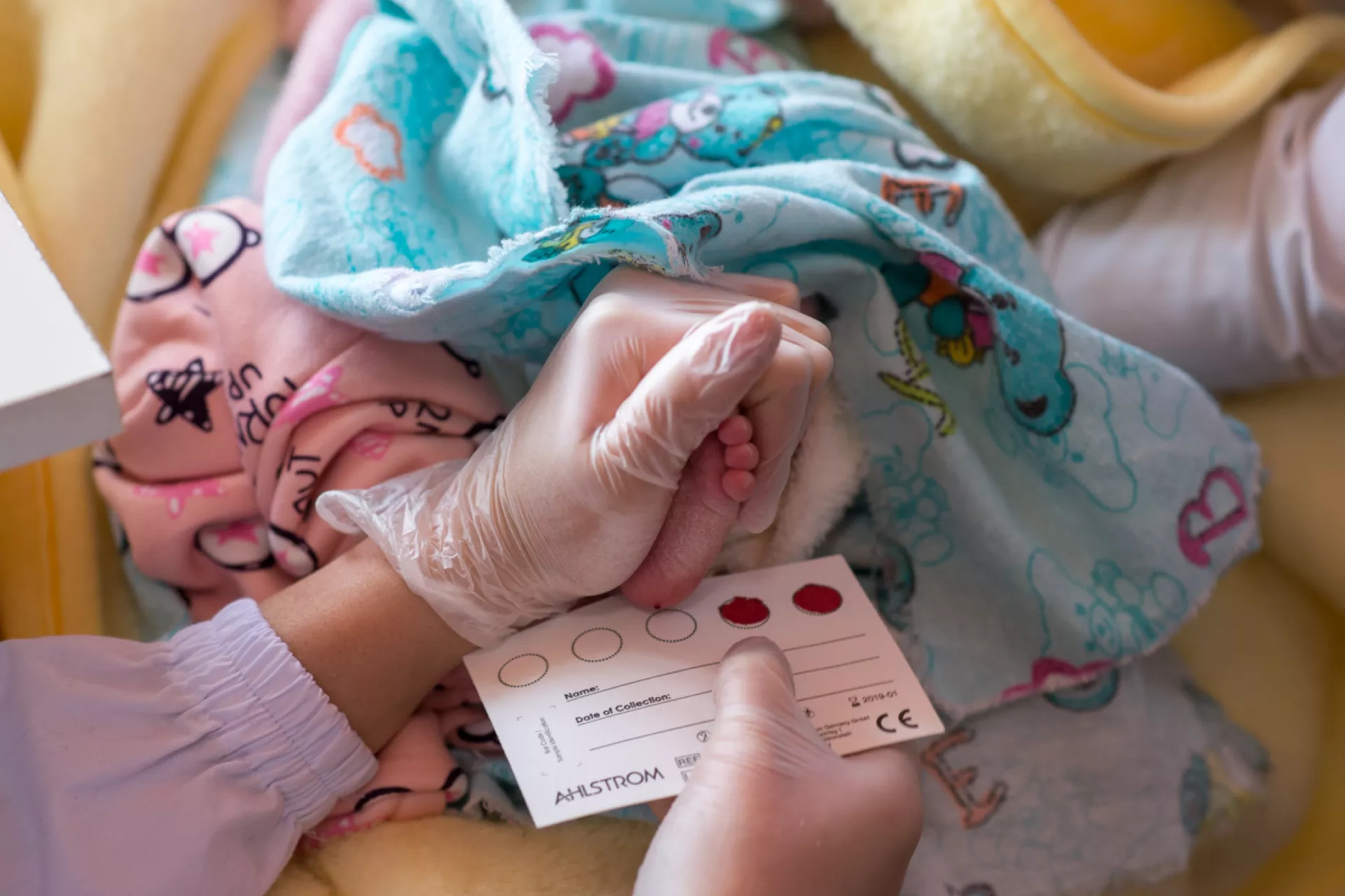 Collection of a one-week-old baby's blood drop for subsequent instant analysis on HIV.