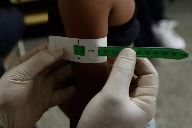 A health worker measures the arm circumference of a 3-year-old girl