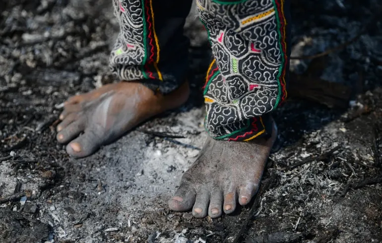 Los pies de un nino sobre un terreno en cenizas luego de un incendio forestal