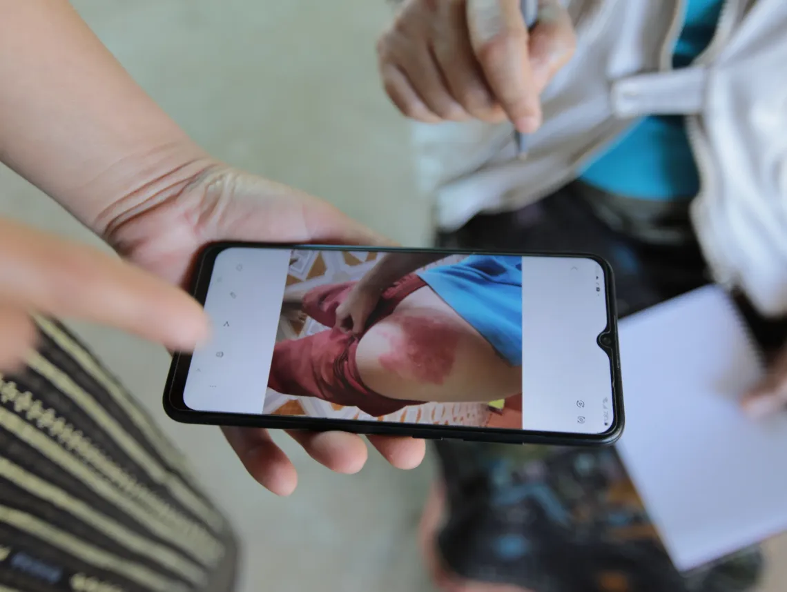 Ms. Phone showed her son's injury.