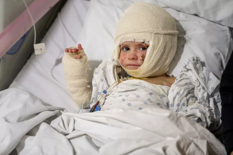 Ivana, two-year-old girl suffering from burn injury  