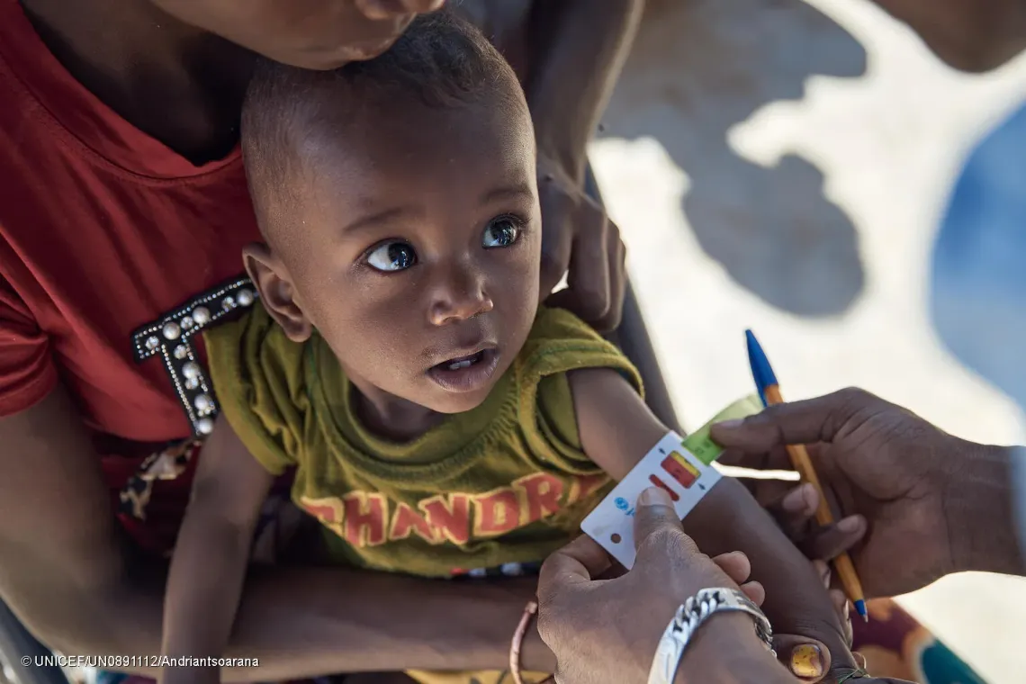 Fidison, &acirc;g&eacute; de 11 mois, se fait mesurer le p&eacute;rim&egrave;tre brachial. Le r&eacute;sultat se situe dans la zone rouge, signe d'une malnutrition aigu&euml; s&eacute;v&egrave;re.