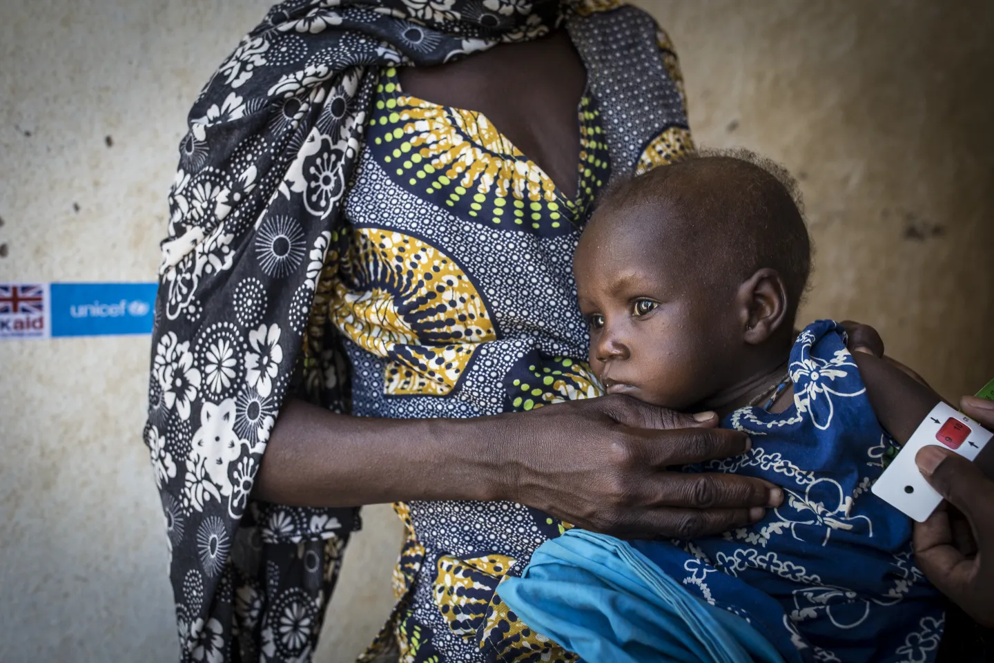 un enfant malnutri entrain de se faire depister