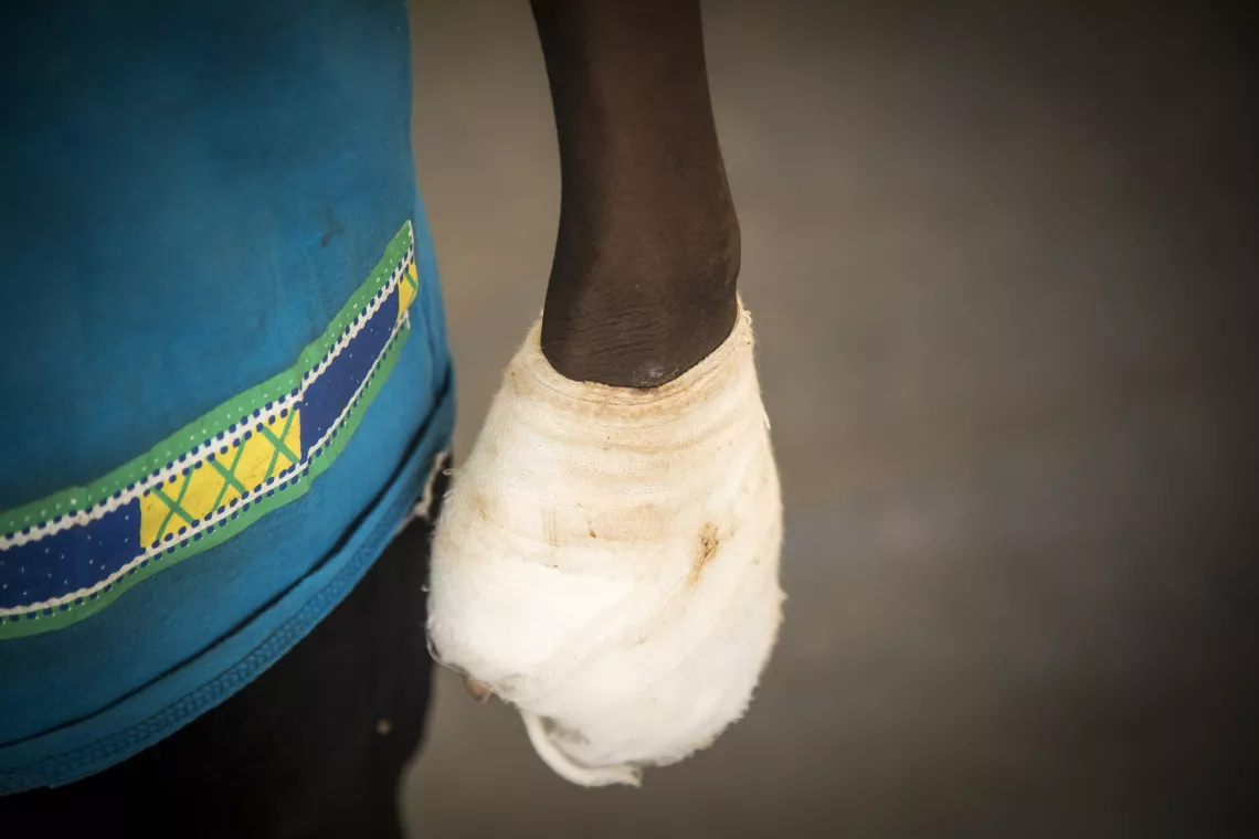  Issa *, 14 ans, la main gauche est maintenant étroitement enveloppée dans un bandage.