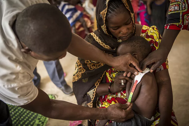 Un enfant entrain de se faire d&eacute;pister de la malnutrition
