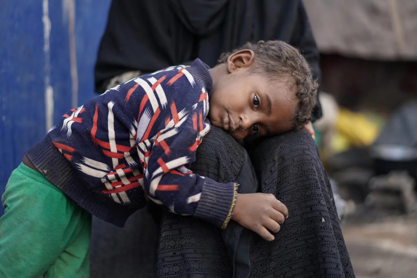 2-year-old Ismail Abdo Ahmed rests on the knees of his mother,