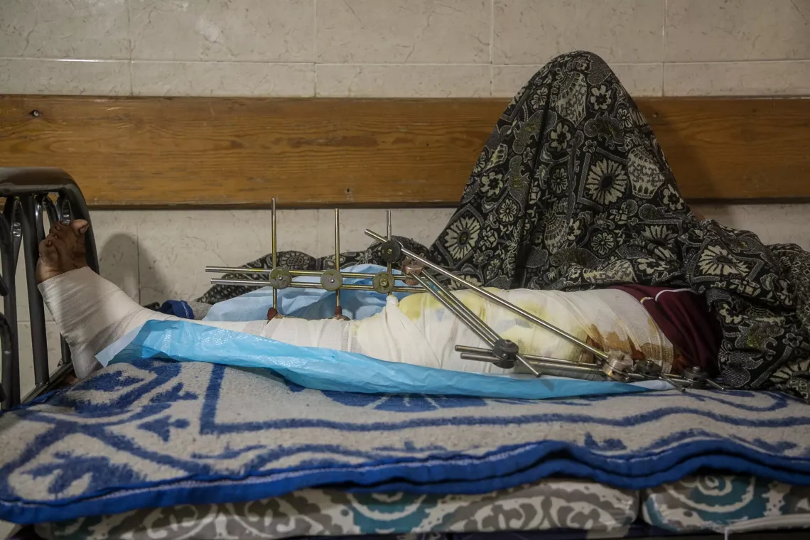 Gaza. A close up of Bilal's injured knee as he lays in hospital.