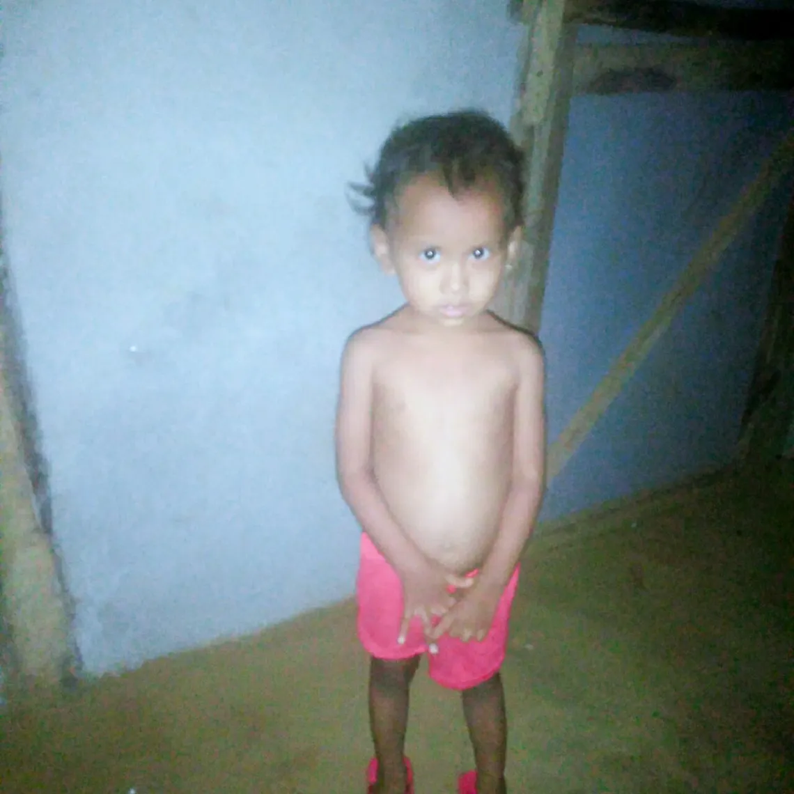 A photo of a younger and malnourished Unisha.