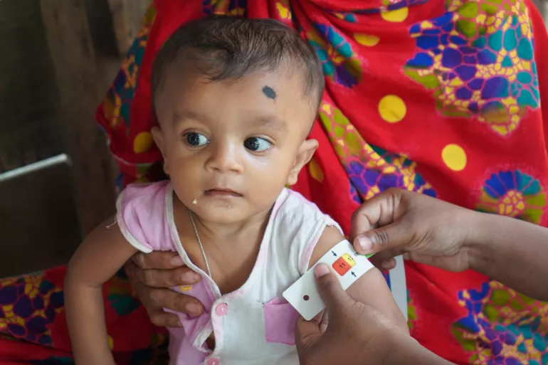 This image shows a young child being screened using a mid-upper arm circumference measuring tape