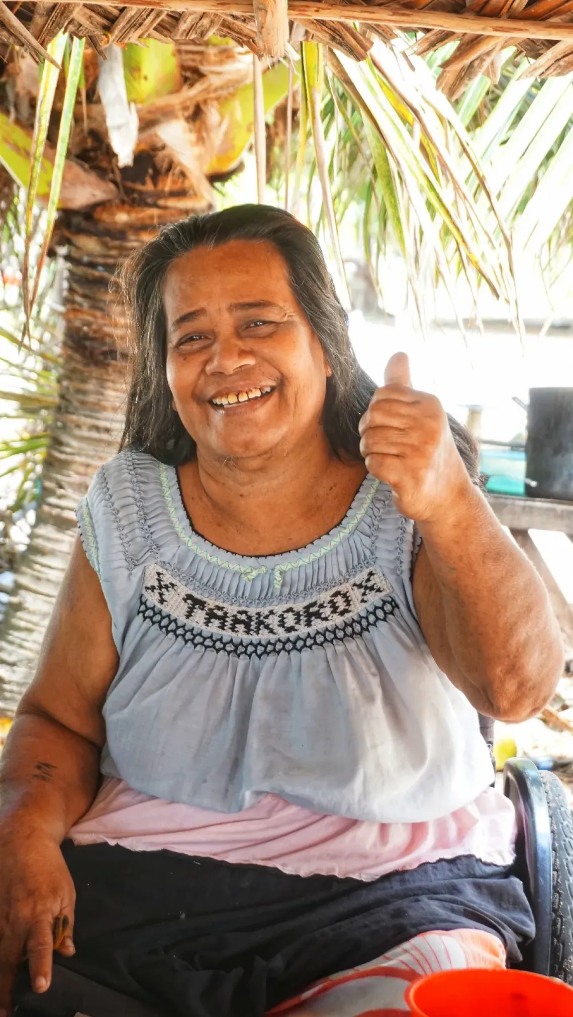 Rita, from Kiritimati island in Kiribati, sits in a wheelchair under a palm tree, with a thumbs up and smile