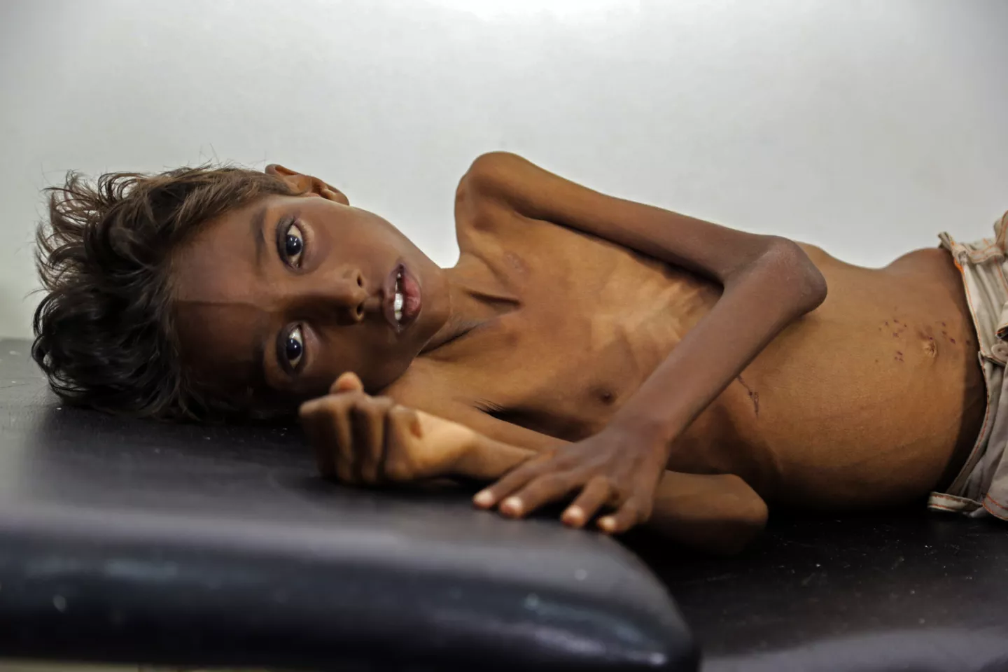Five-year-old Mohanned