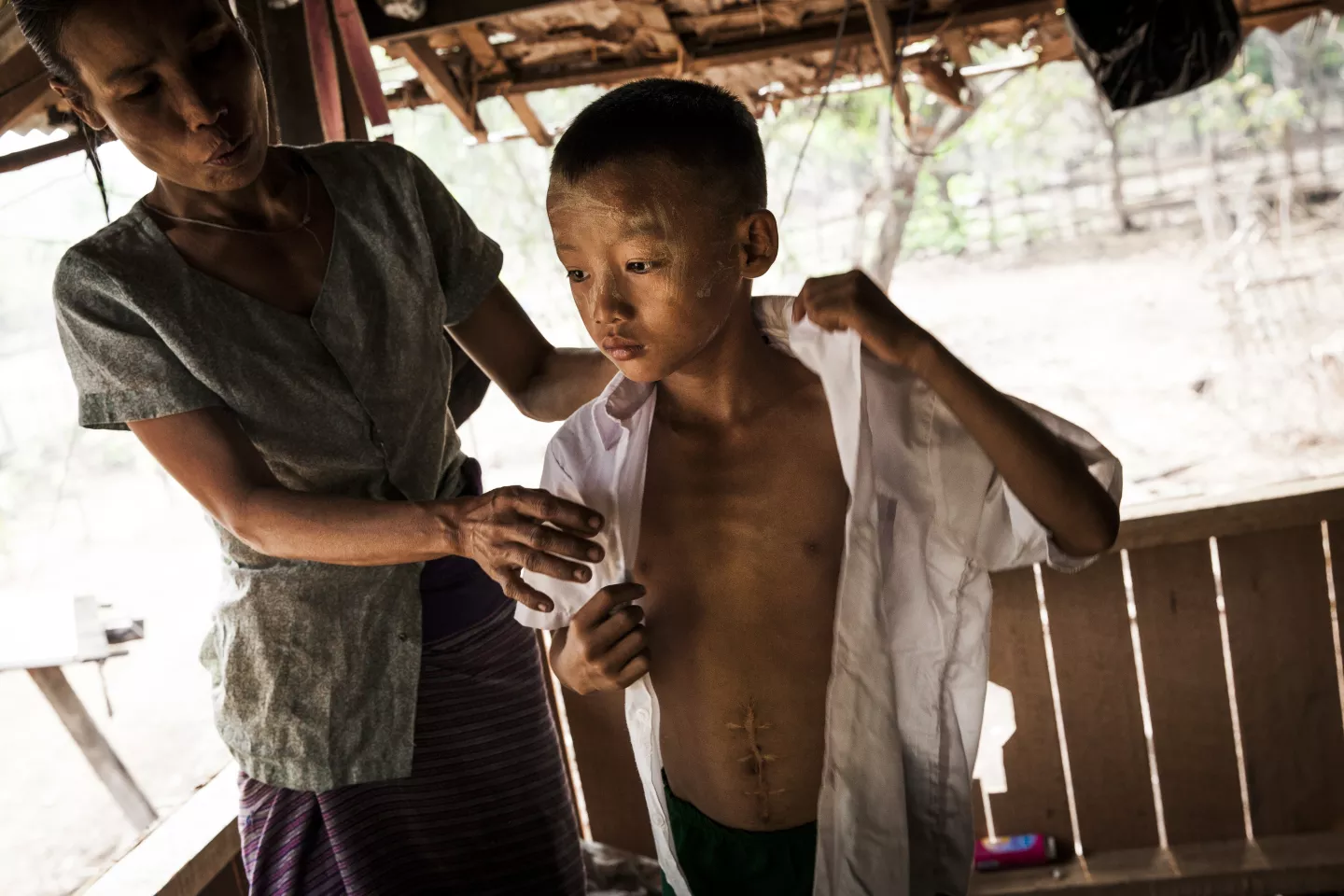 A ten-year-old boy in Myanmar shows a large scar from injuries he sustained while playing with an explosive remnant of war in 2017.